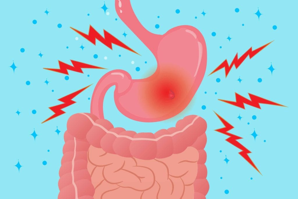 Illustration of a stomach and intestines with red pain signals, symbolizing digestive discomfort against a light blue background.
